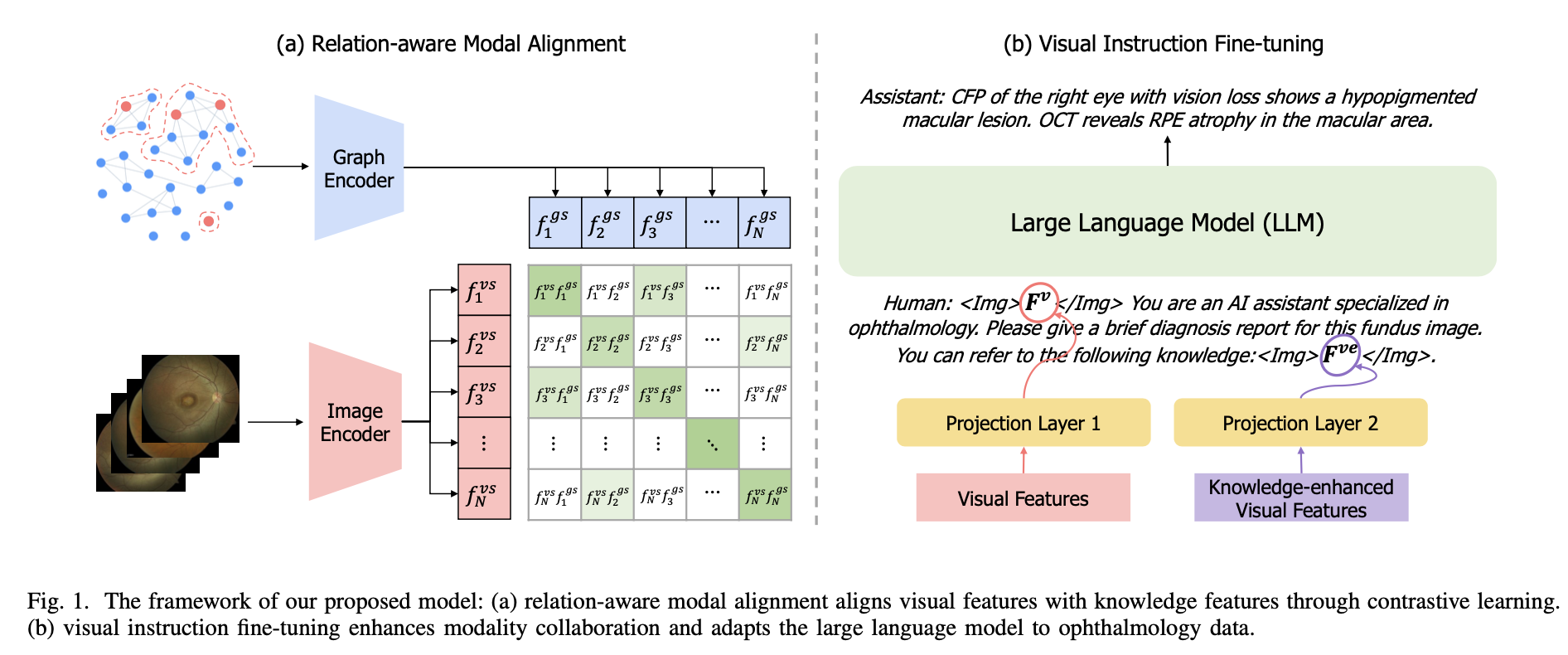EyeGraphGPT: Knowledge Graph Enhanced Multimodal Large Language Model for Ophthalmic Report Generation